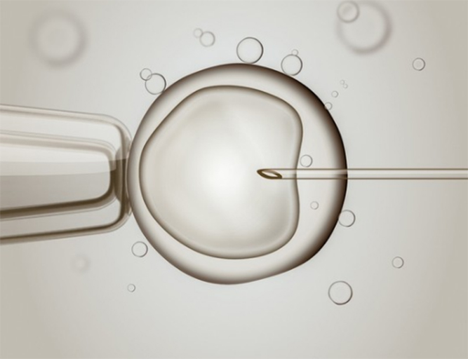 做一代试管鲜胚移植后的注意事项有哪些