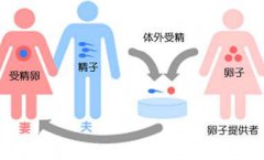 广州市三代试管的着床率提升得如此简单!