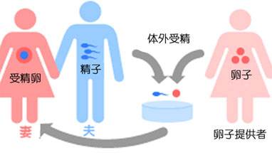 在广州市做三代供卵试管需要多少钱？